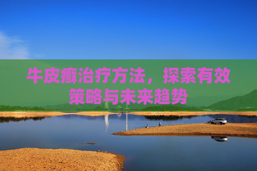 牛皮癣治疗方法,探索有效策略与未来趋势 牛皮癣治疗方法,探索有效策略与未来趋势
