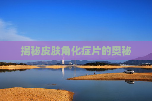 揭秘皮肤角化症片的奥秘
