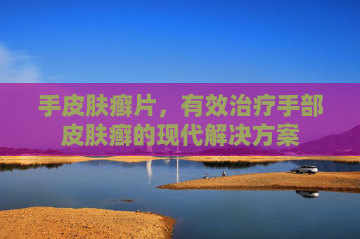 手皮肤癣片，有效治疗手部皮肤癣的现代解决方案