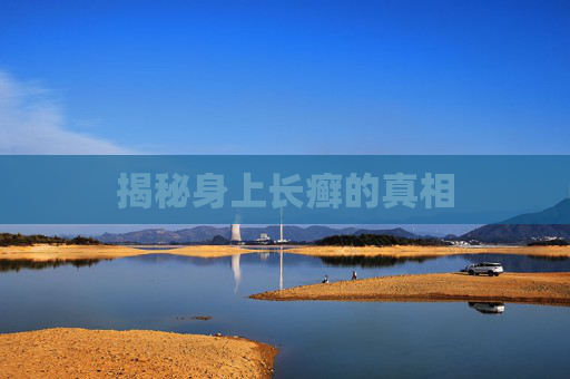 揭秘身上长癣的真相